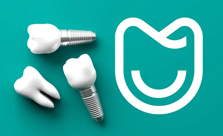 Dental Implants Important Alternative For Many Prosthesis